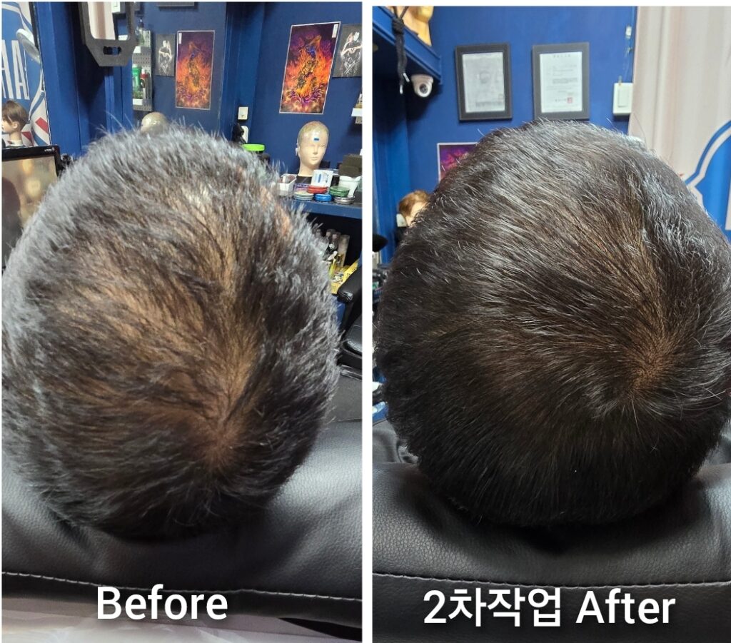 탈모 밀도보강 두피문신 학원