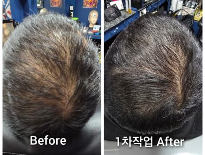 두피문신 교육 학원 수강 아카데미 무료